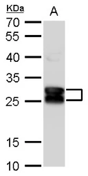 Anti-beta A3 Crystallin antibody [N1C3] used in Western Blot (WB). GTX109207